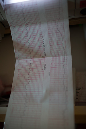 Birth-Hospital Stay-1602