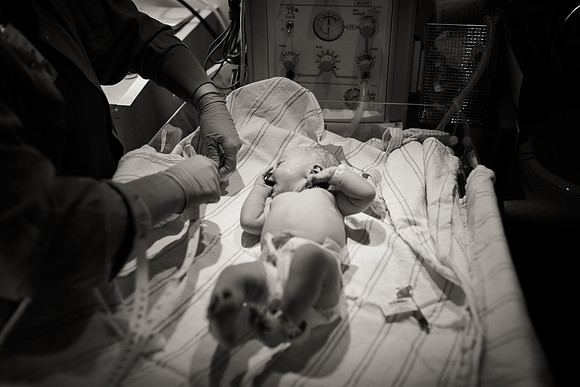 Birth-Hospital Stay-1615-2